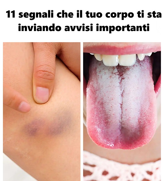11 segnali che il tuo corpo ti sta inviando avvisi importanti