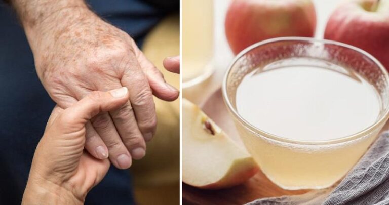 Rimuovi le macchie dalle mani con questo ingrediente: sorprendente