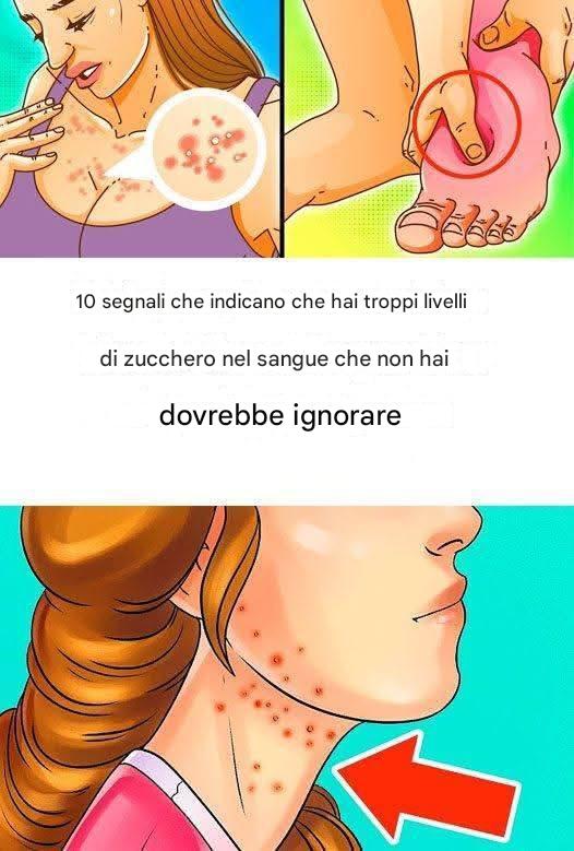 10 segnali che stai mangiando troppo zucchero