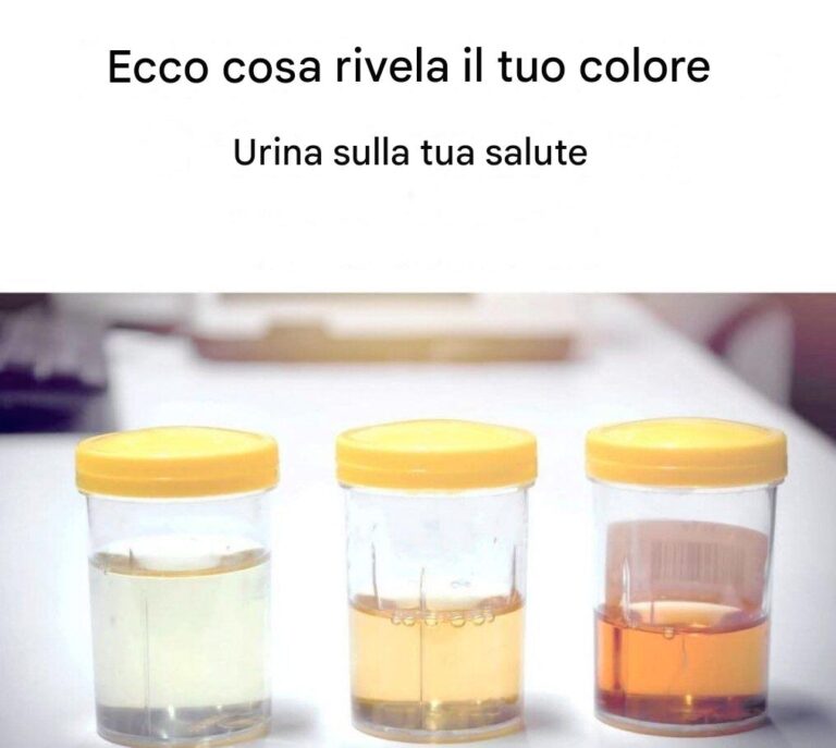 Cosa dice il colore della tua urina sulla tua salute