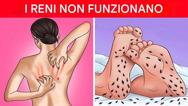 8 strani segnali che indicano che i tuoi reni hanno bisogno di aiuto