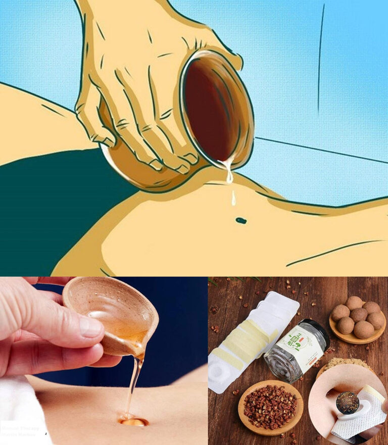 Poche gocce di questo olio essenziale sull'ombelico alleviano il dolore e la digestione.