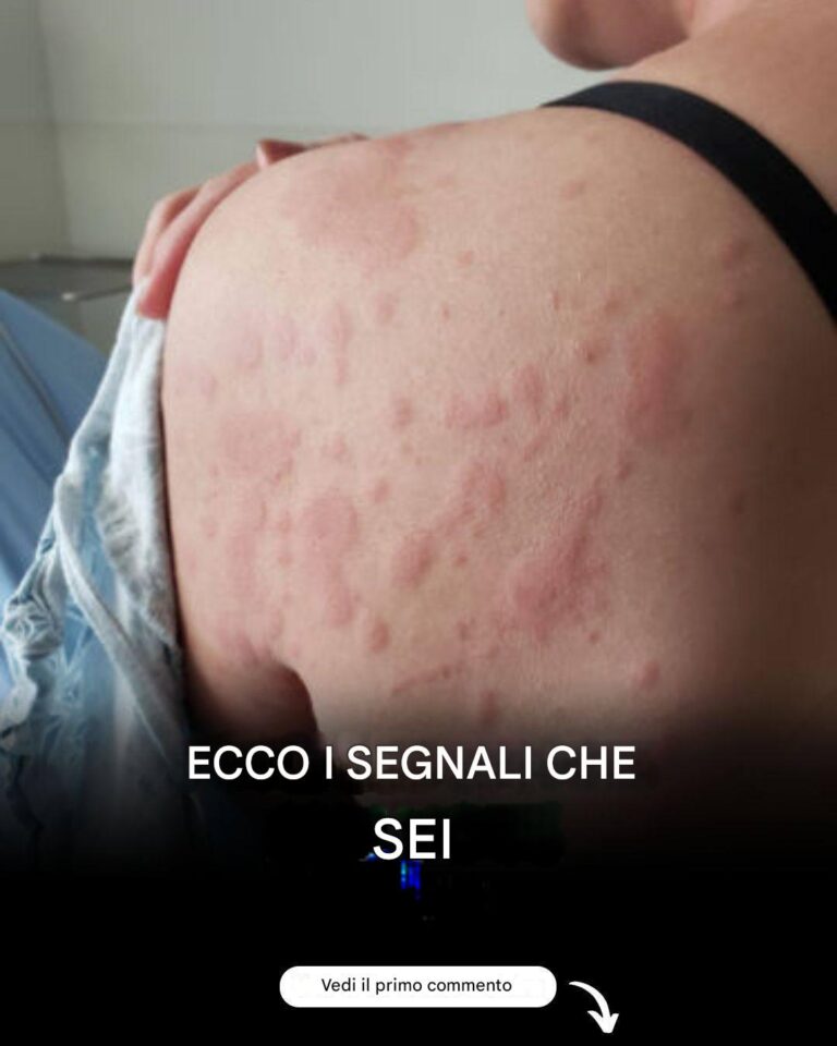 Orticaria? Allergia? Tutto il suo corpo prudeva, i dottori diagnosticarono il peggio