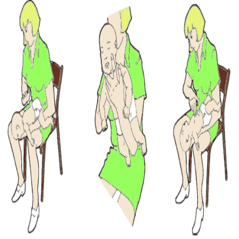Primo soccorso per prevenire il soffocamento nei neonati