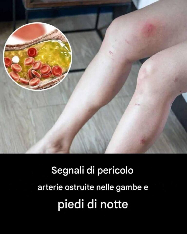 Come i tuoi piedi potrebbero segnalare problemi cardiaci e arterie ostruite