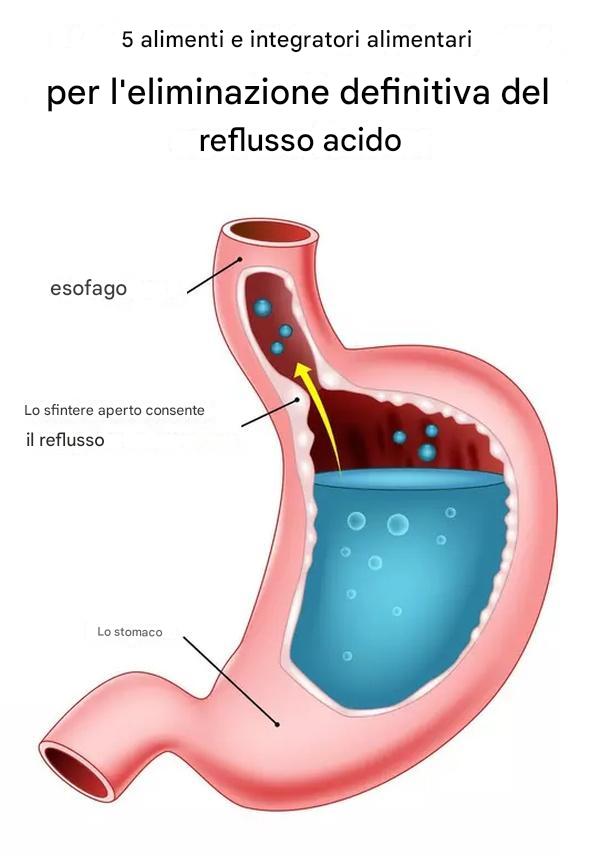 5 vitamine per fermare il reflusso acido in modo naturale