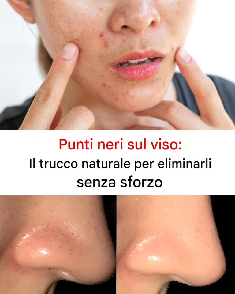 Come rimuovere i punti neri dal viso?