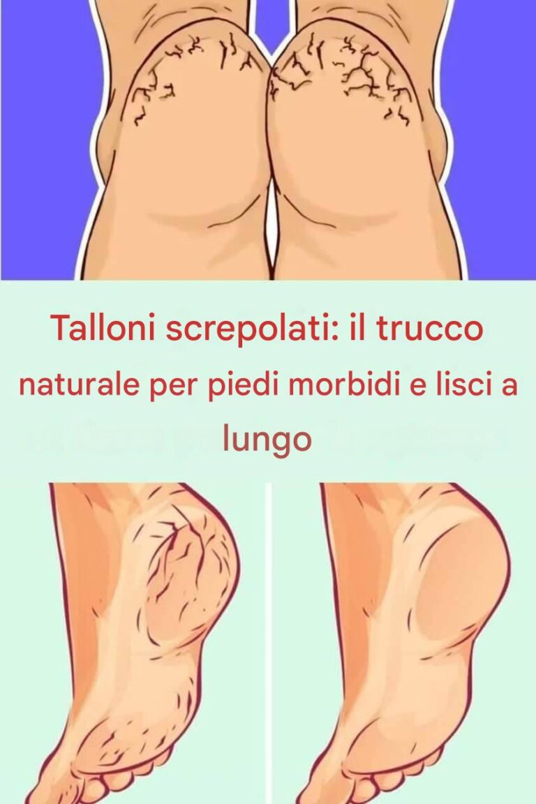 Talloni screpolati: il trucco naturale per piedi morbidi e lisci a lungo
