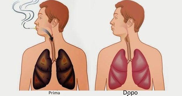 Per fumatori ed ex fumatori: 6 modi per purificare e rivitalizzare i polmoni