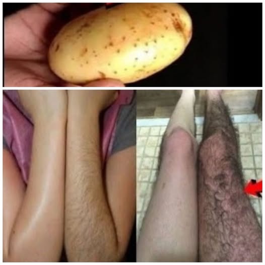 Ecco come sbarazzarsi definitivamente dei peli di viso, corpo e pube usando la patata!