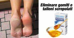 Sbarazzati di gomiti e talloni screpolati con questo incredibile rimedio