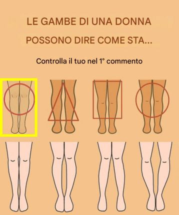 Cosa possono rivelare le tue gambe sulla tua salute?