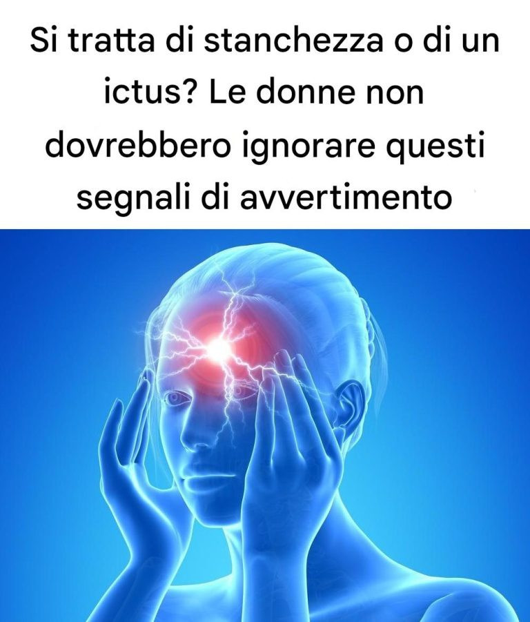 Si tratta di stanchezza o di un ictus? Le donne non dovrebbero ignorare questi segnali di avvertimento