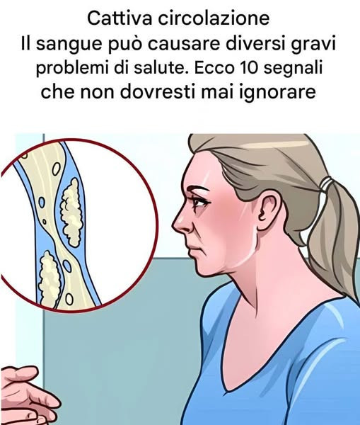 segnali essenziali di cattiva circolazione sanguigna