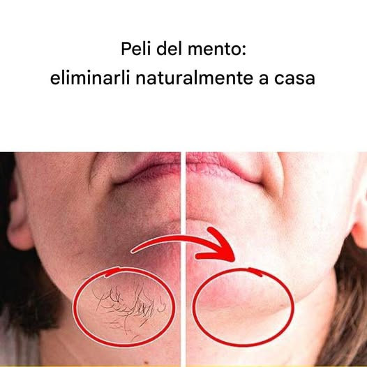 Rimuovere i peli del mento senza danneggiare la pelle: la soluzione naturale