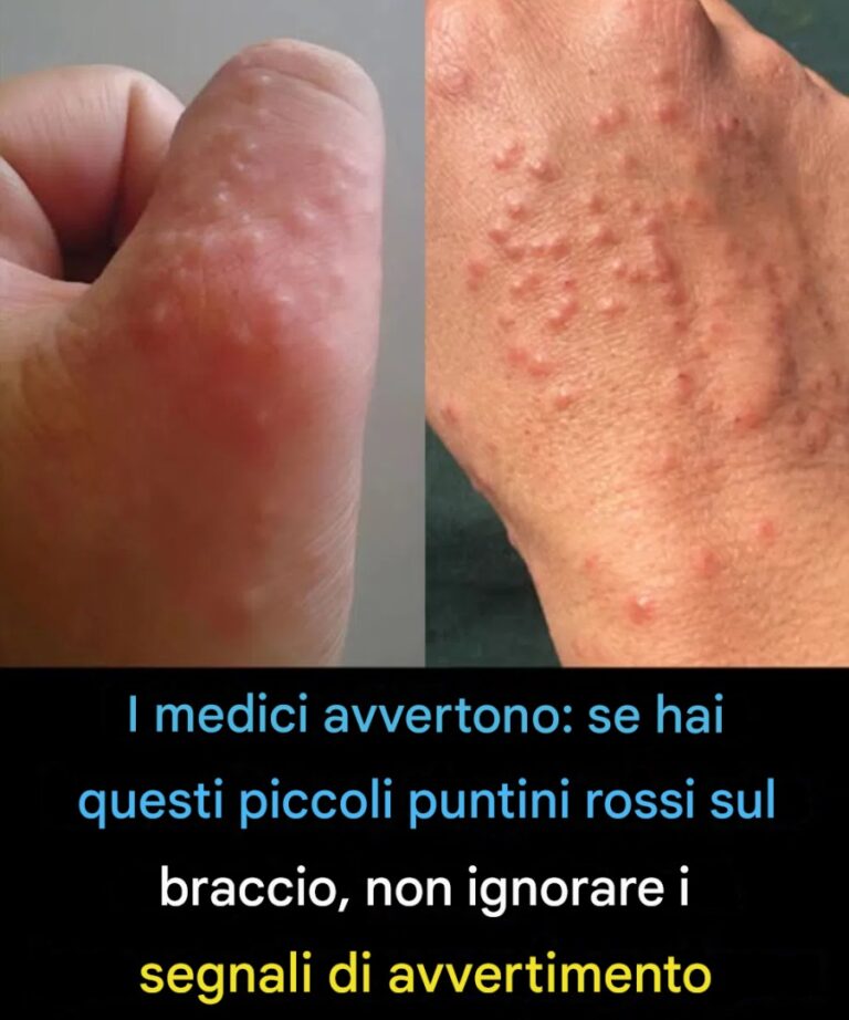 Non trascurare queste piccole macchie rosse sul braccio: potrebbero essere importanti segnali di allarme