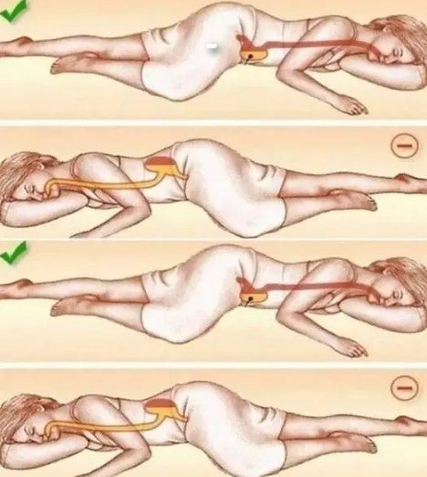 Dormire sul lato sinistro influisce sulla tua salute in modi che non avresti mai immaginato