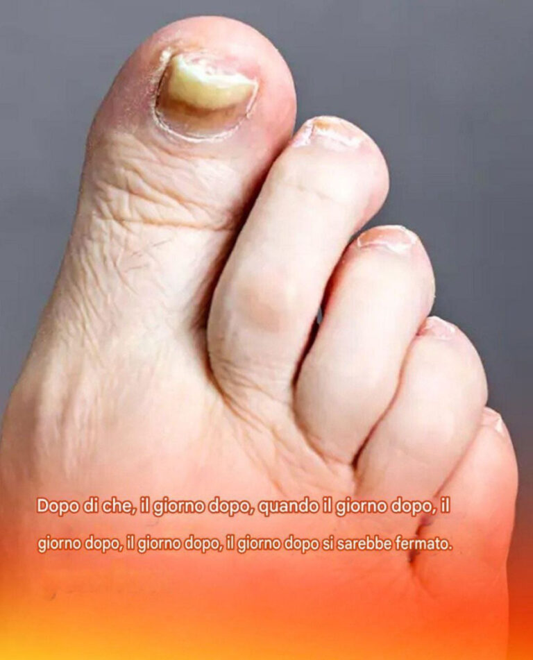 3 segni impercettibili sui piedi che potrebbero essere il segnale di un killer silenzioso