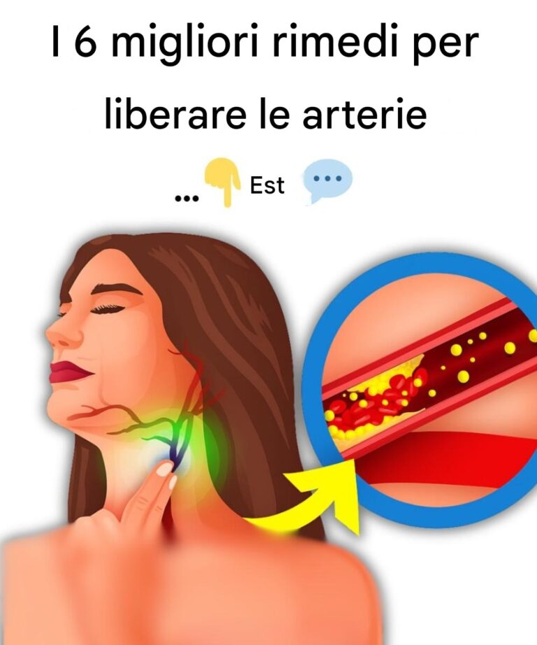 I 6 migliori rimedi per pulire le arterie