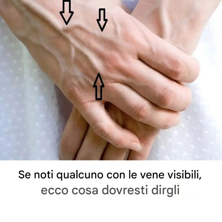 I misteri delle vene visibili: cosa rivela la tua pelle sulla tua salute