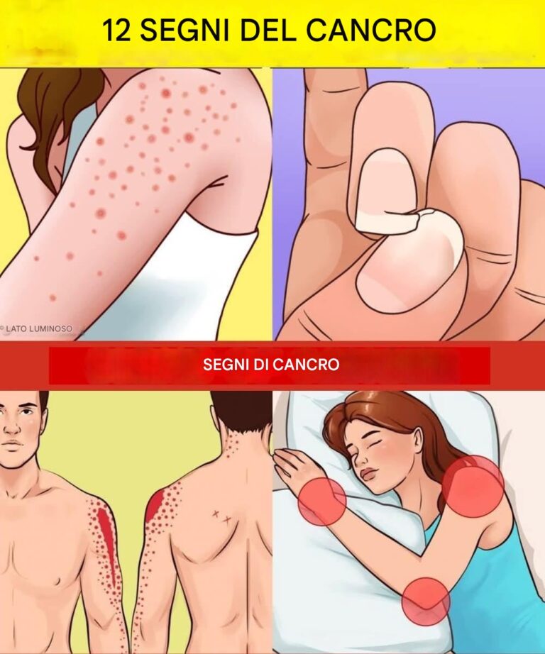Questi sono i primi sintomi della ca… Scopri di più