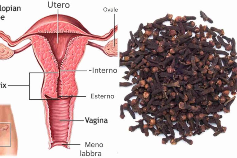 Ecco come usare i chiodi di garofano per purificare l'utero