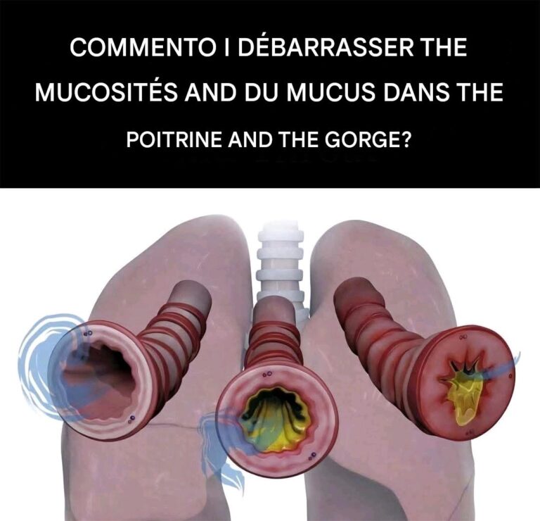 8 Ways to Get Rid of Mucus and Phlegm in Chest and Throat