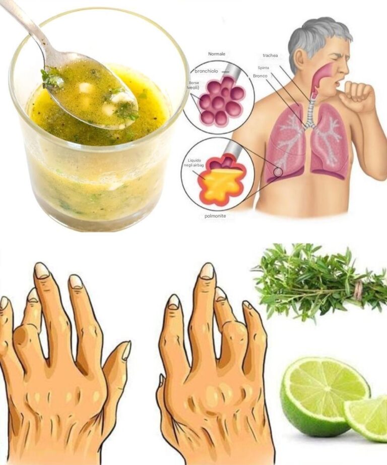 Timo e limone: un rimedio naturale contro artrite e infiammazioni