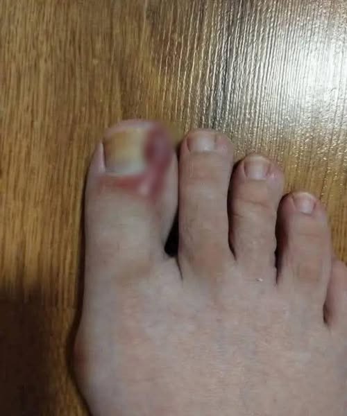 🔴Segnali sui tuoi PIEDI che mostrano che sei... Scopri di più