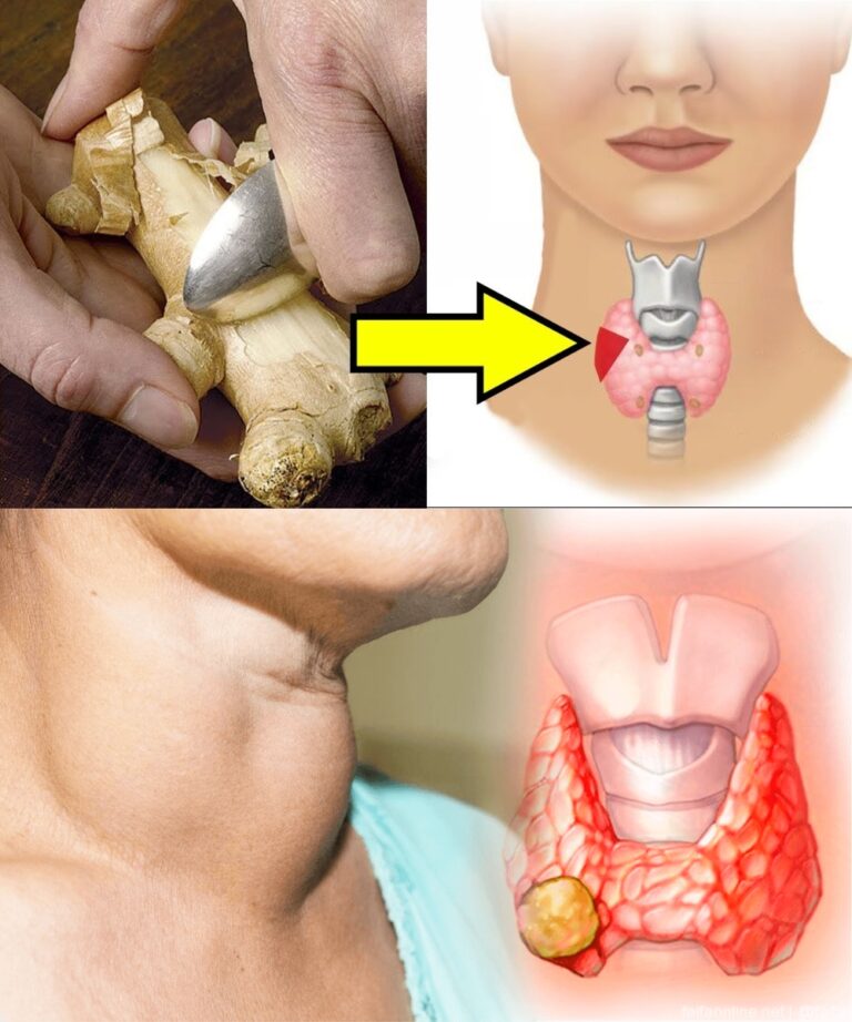 19 alimenti da evitare se si soffre di ipotiroidismo o problemi alla tiroide