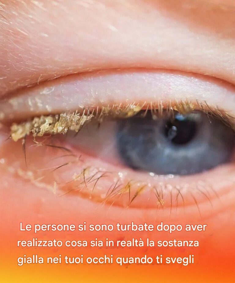 Le persone si sono turbate dopo aver realizzato cosa sia in realtà la sostanza gialla nei tuoi occhi quando ti svegli