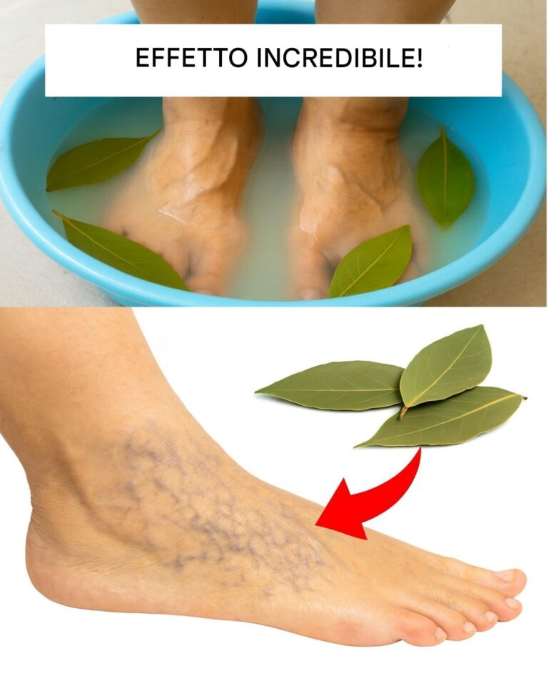 Più forte dell'aglio e del limone: la magia dei pediluvi all'alloro