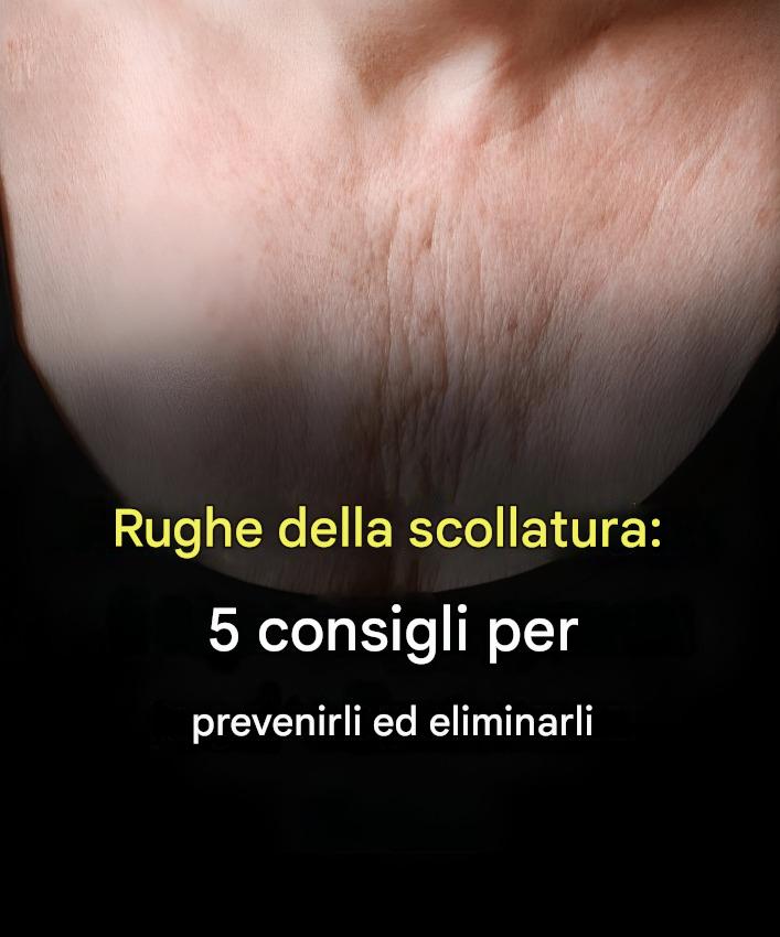 Rughe del décolleté: 5 consigli per prevenirle ed eliminarle