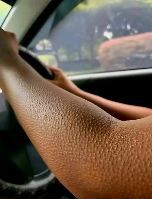 Se la tua pelle ha questo aspetto, ecco cosa significa veramente