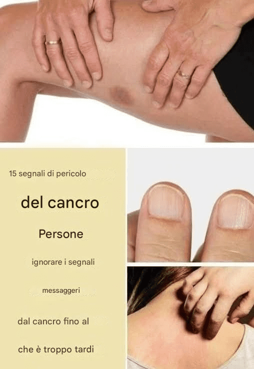 15 segnali d'allarme del cancro che le persone ignorano finché non è troppo tardi