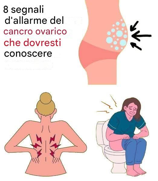 8 segnali d'allarme del cancro ovarico che non dovresti ignorare