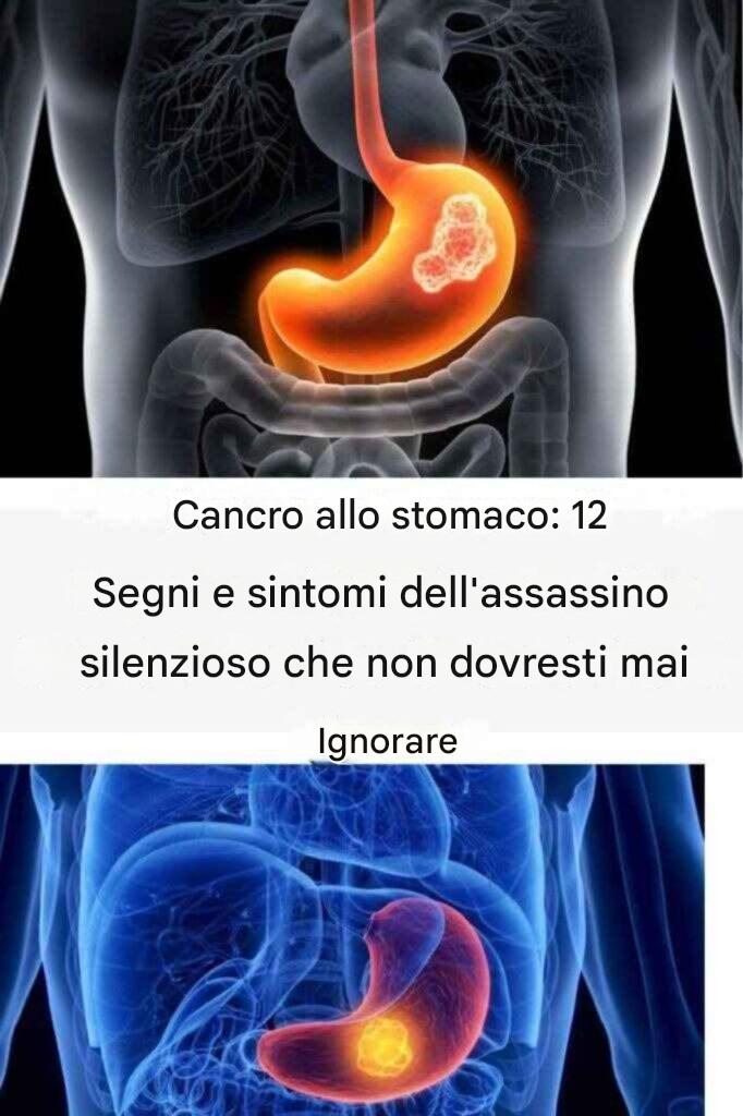 Cancro allo stomaco: 12 segnali e sintomi del killer silenzioso che non dovresti mai ignorare