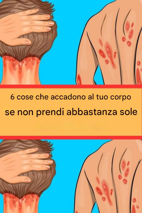 6 cose che accadono al tuo corpo se non prendi abbastanza sole