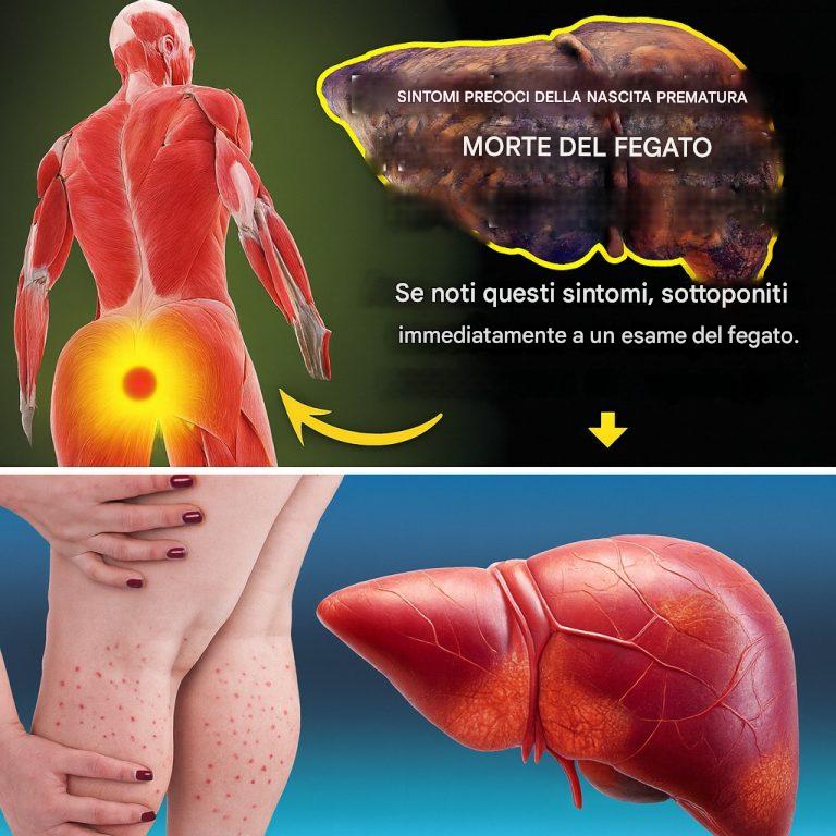 Pensi di essere sano? Ma il tuo fegato potrebbe non essere d'accordo... Non ignorare questi 12 segnali d'allarme nascosti!