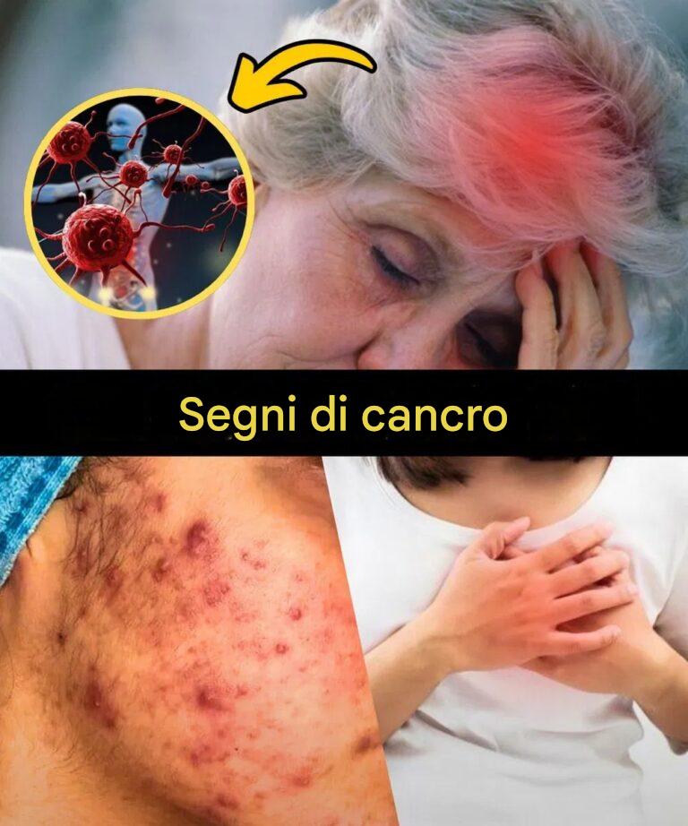 14 segni visibili del cancro che la maggior parte delle donne ignora
