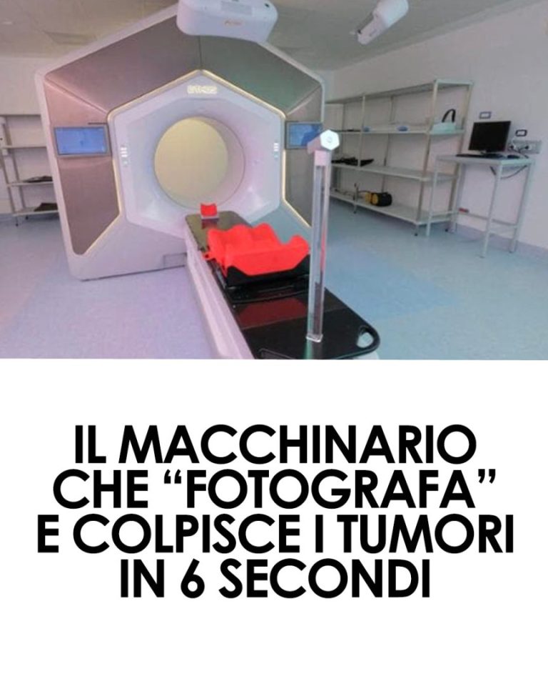 Hypersight: la Nuova Radioterapia Ultra-Precisa Contro i Tumori