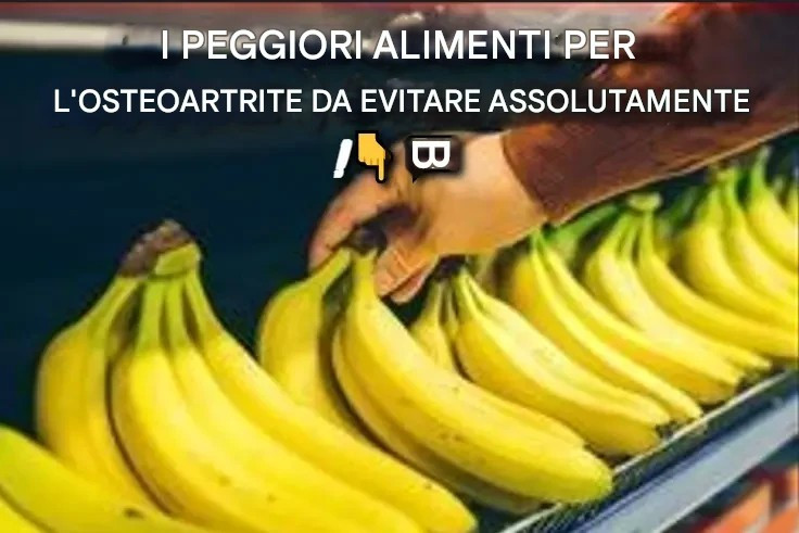 I 6 peggiori alimenti contro l'osteoartrite da evitare assolutamente!