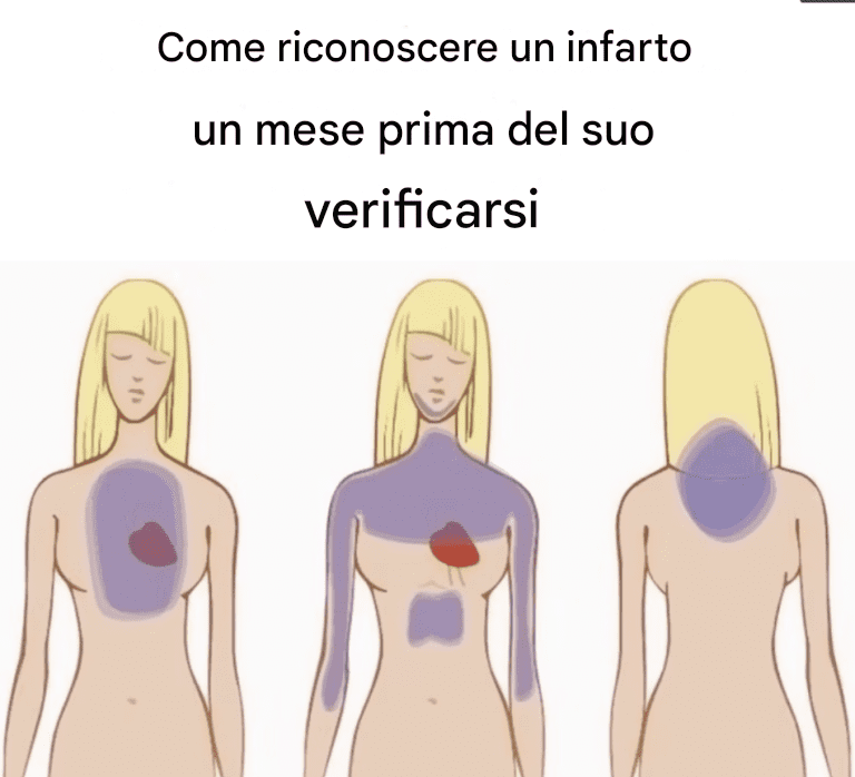 Come riconoscere un infarto un mese prima che accada
