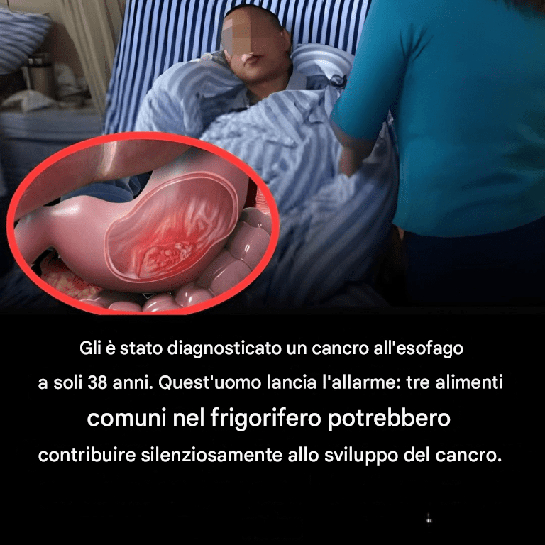Un uomo di 38 anni con cancro allo stomaco avverte: 3 cibi da evitare