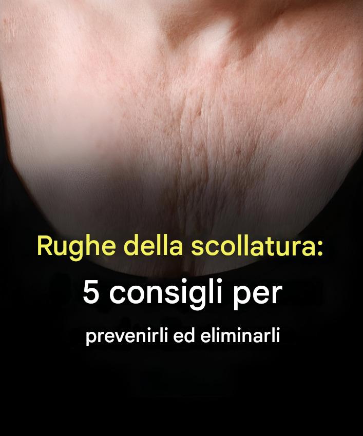 Rughe del décolleté: 5 consigli per prevenirle ed eliminarle