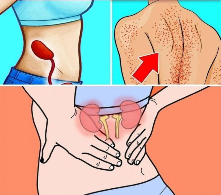 10 segnali che indicano che i tuoi reni non funzionano correttamente (1/4)
