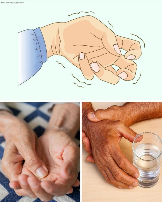 Non solo paura del palcoscenico: scoprire la verità dietro il tremore rivelato...