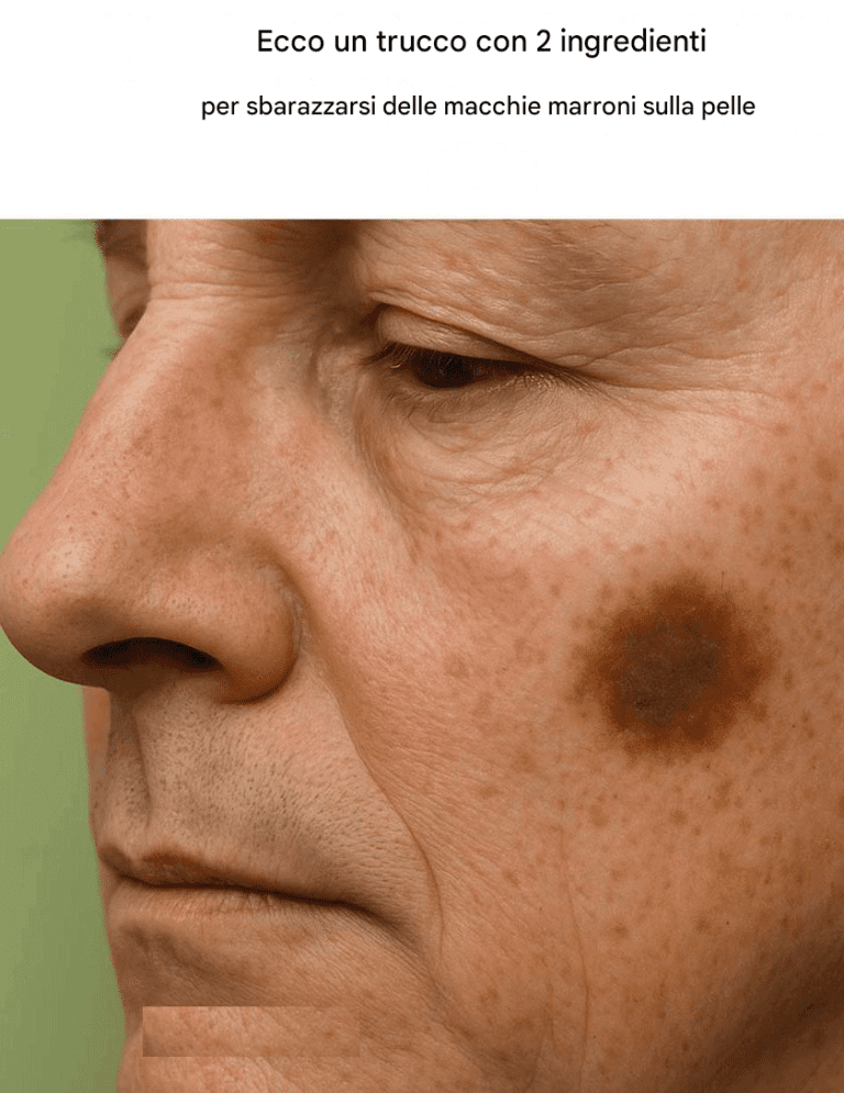 Ecco un trucco con due ingredienti per sbarazzarsi delle macchie marroni sulla pelle.