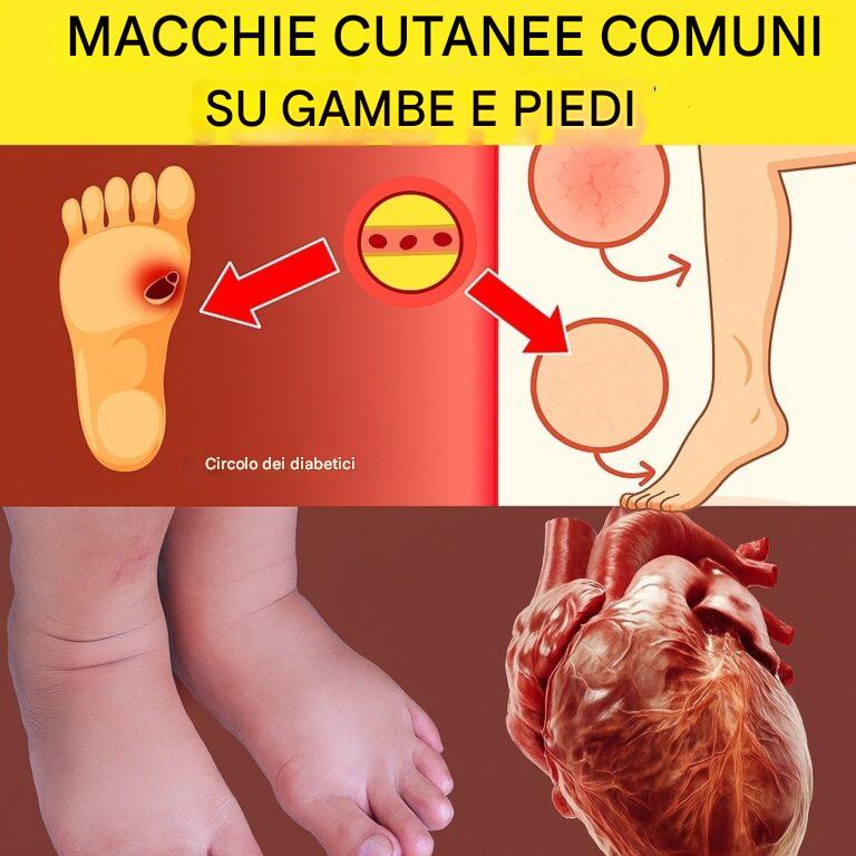 12 segnali nelle gambe e nei piedi che potrebbero indicare problemi di circolazione