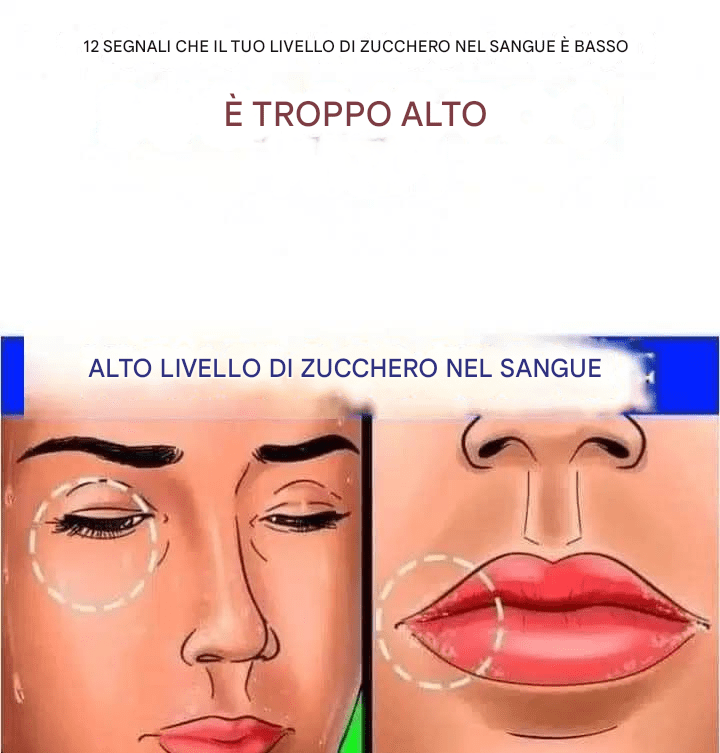 Allarme glicemia alta: come riconoscere i 12 sintomi principali che il tuo corpo ti mostra.